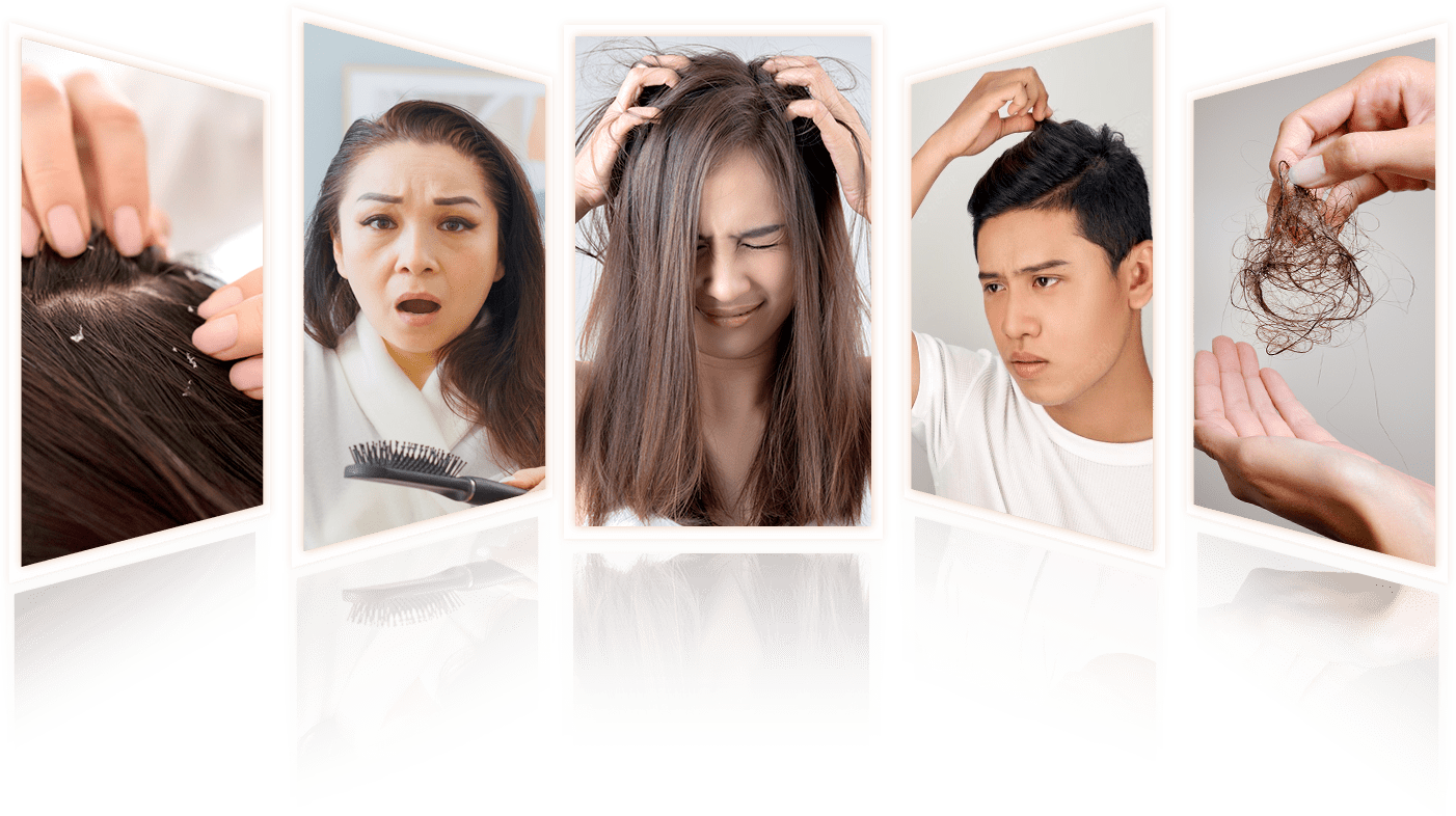 kiểm tra nang tóc