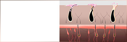 Kiểm tra tốc độ rụng tóc