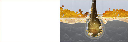 Dự đoán chiều hướng rụng tóc