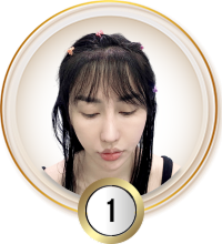 Cấy tóc việt nam