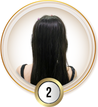 Cấy tóc việt nam