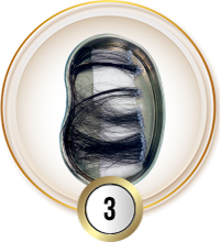 Cấy tóc việt nam