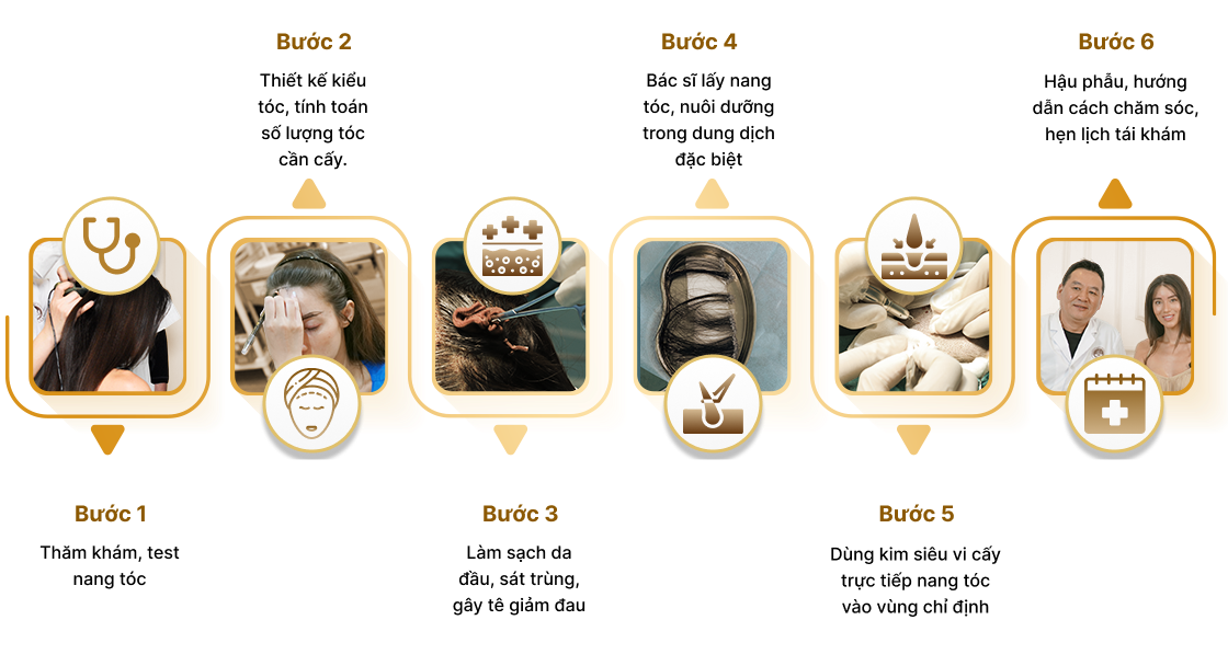 Cấy tóc việt nam