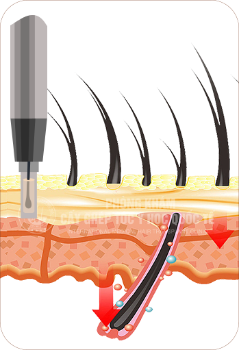 ƯU ĐIỂM VƯỢT TRỘI