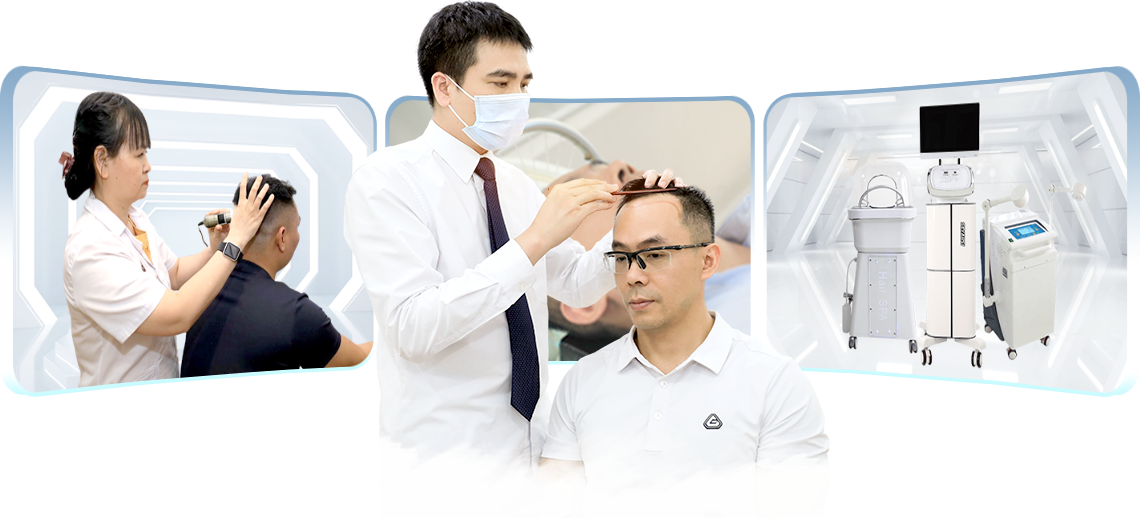 cấy ghép tóc y học hà nội