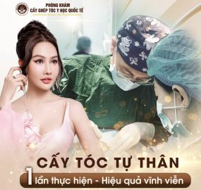 Xu hướng mới: Cấy tóc tự thân trị hói