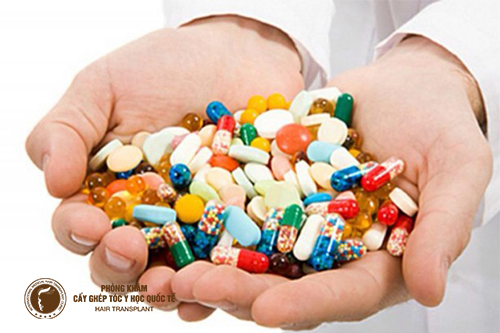 Review 5 loại thuốc chống hói đầu trên thị trường hiện nay
