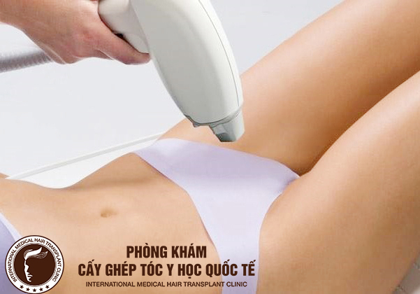 Giải đáp thắc mắc: Có nên triệt lông vùng kín hay không?