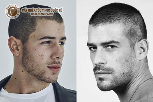 Top 5 kiểu tóc cho người hói đầu hot nhất hiện nay