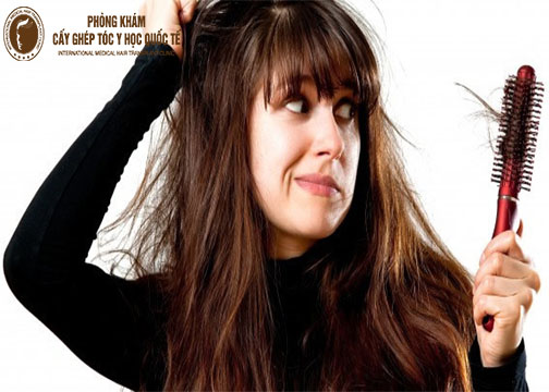 Giải đáp thắc mắc “Rụng tóc có nguy hiểm không?”