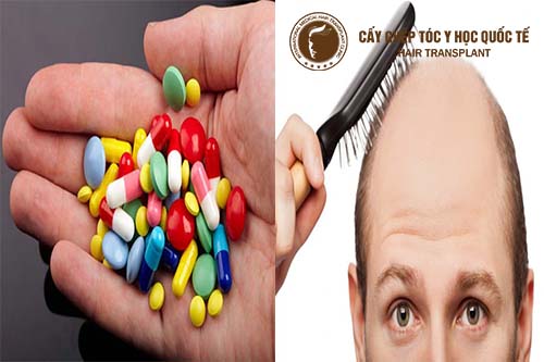 Dùng thuốc mọc tóc có hiệu quả không?
