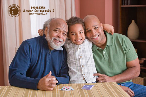 Hói đầu di truyền có chữa được không?
