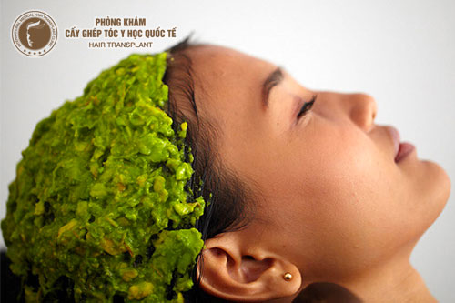 5 loại mặt nạ phục hồi tóc hư tổn hiệu quả không ngờ