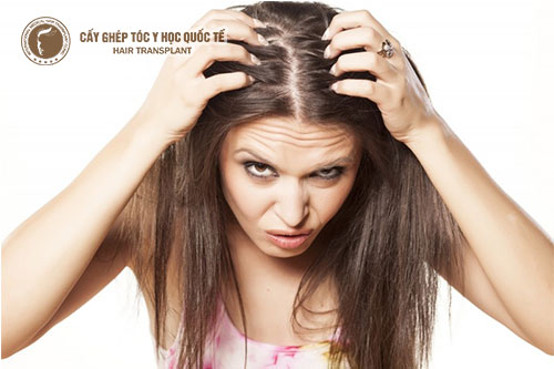 Nguyên nhân và cách điều trị ngứa da đầu