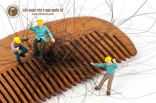 Khi bị rụng tóc đi khám ở đâu?