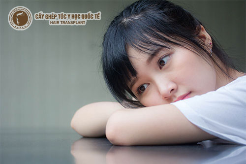 Rụng tóc ở tuổi dậy thì: Lý giải nguyên nhân và cách điều trị