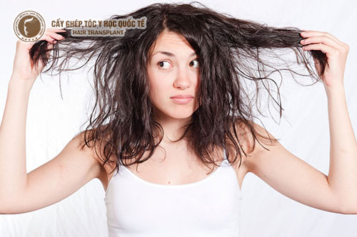 Tóc dầu nên làm gì? Đây là 10 cách khắc phục đơn giản nhất