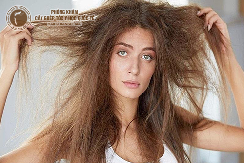 TOP 5 bộ sản phẩm phục hồi tóc hư tổn tốt nhất hiện nay