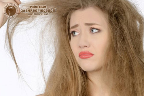 Phục hồi tóc hư tổn là chuyện nhỏ nếu biết rõ được 3 điều này