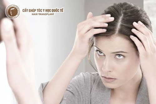 5 thói quen gây hói đầu hầu như ai cũng mắc phải