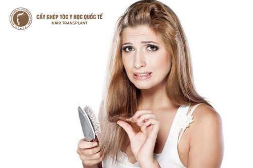 Chữa rụng tóc hiệu quả bằng nguyên liệu tự nhiên