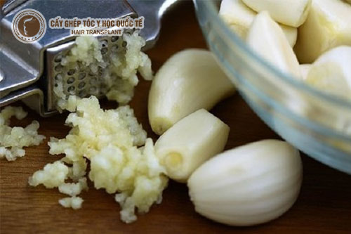 Bí quyết trị hói đầu ở nữ giới từ 5 nguyên liệu nhà bếp quen thuộc
