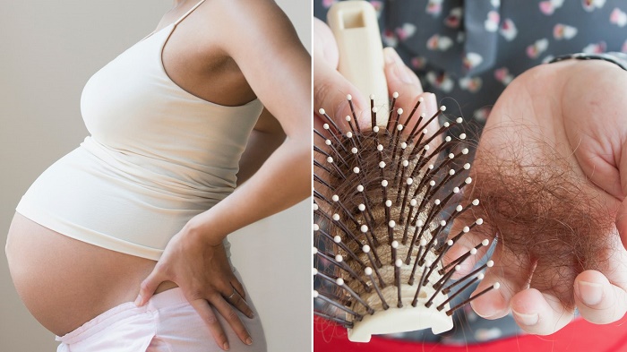 Rụng tóc khi mang thai – Nguyên nhân và cách khắc phục