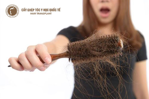 Giảm cân sai cách khiến tóc trên đầu ngày càng thưa mỏng