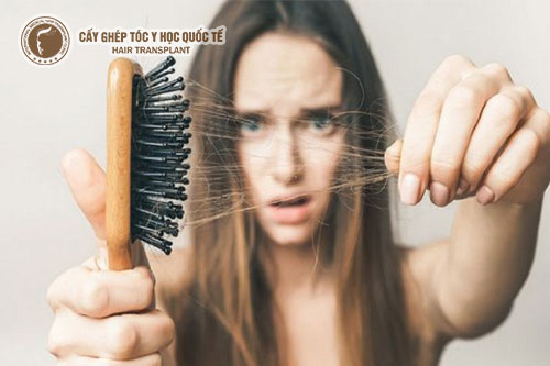 5 NGUYÊN NHÂN RỤNG TÓC KINH HOÀNG AI CŨNG ĐỀU GẶP PHẢI