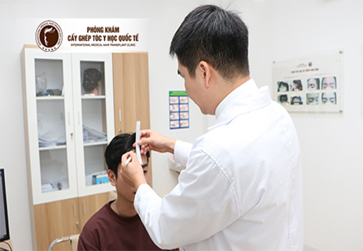 Rụng tóc nam: Nguyên nhân và cách trị dứt điểm