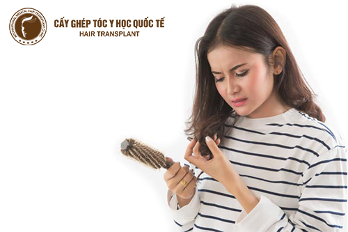Rụng tóc đột ngột có phải bệnh nguy hiểm không?