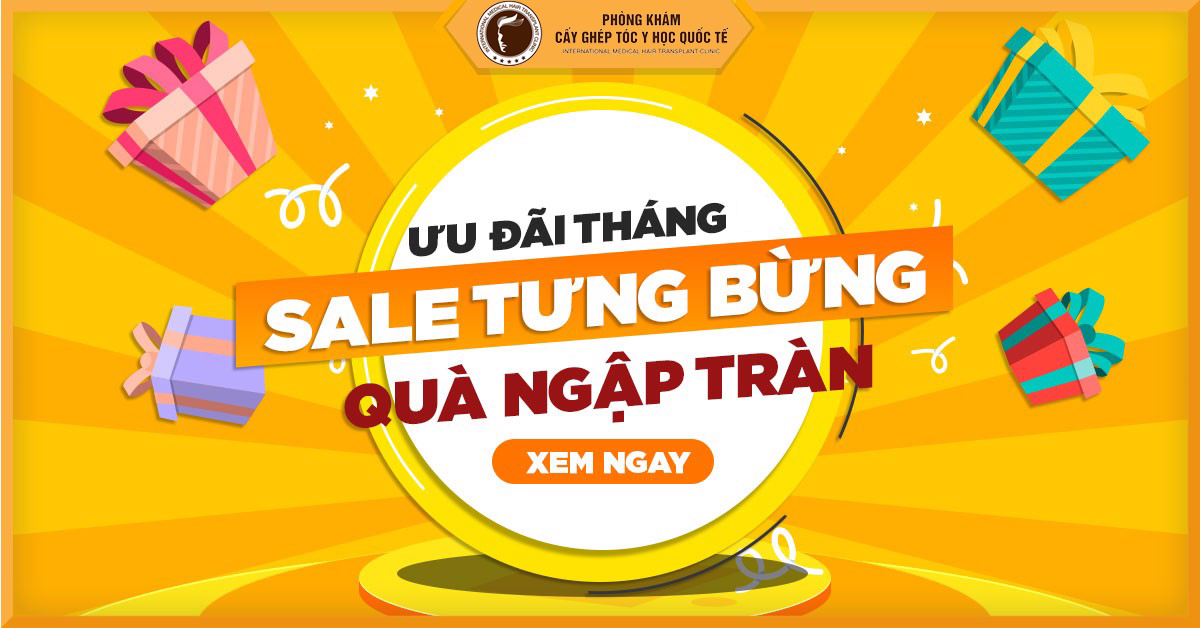 Ưu đãi cấy tóc tưng bừng, chào mừng đại lễ 30/4 – 1/5