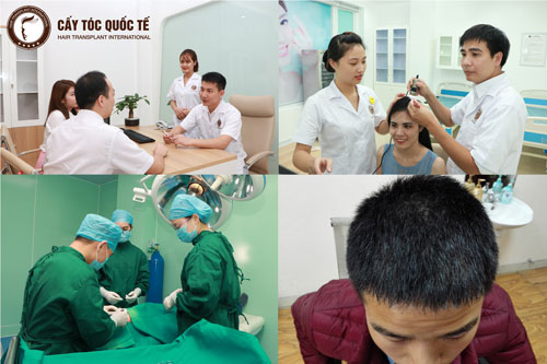 Những điều cần biết về rụng tóc và địa chỉ khám rụng tóc tốt nhất Hồ Chí Minh