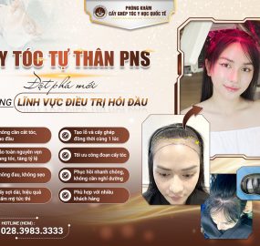 Thay sắc, đổi vận cho người trán cao với công nghệ cấy tóc sợi dài PNS
