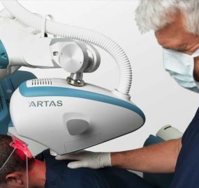 So sánh cấy tóc bằng robot và con người: Đâu là lựa chọn tối ưu nhất?